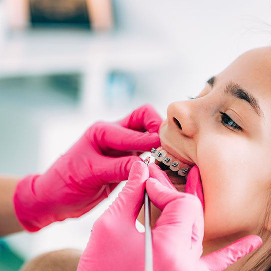 Braces: Before, During, and After - MyOrthodontist - braces preparation